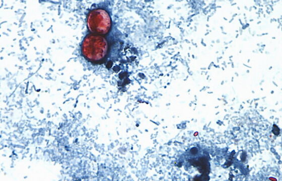 Fresh lettuce displayed as officials investigate a multistate Cyclospora outbreak