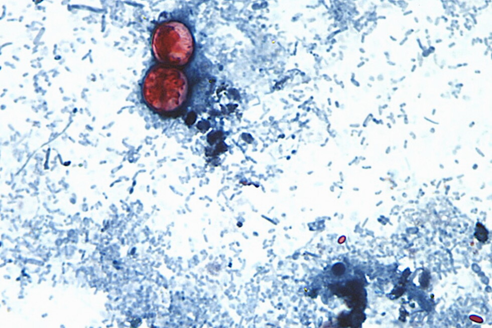 Fresh lettuce displayed as officials investigate a multistate Cyclospora outbreak